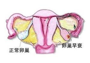 得了卵巢囊肿有什么危害?